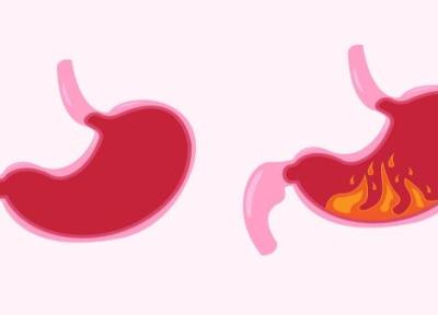 رژیم غذایی برای رفلاکس معده، برترین غذاها برای کاهش اسید معده رژیم غذایی برای رفلاکس معده، برترین غذاها برای کاهش اسید معده