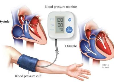 راهنمای کامل پرفشاری خون ، شرح ساده و علمی برای همه راهنمای کامل پرفشاری خون ، شرح ساده و علمی برای همه